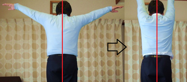 ビフォーアフター