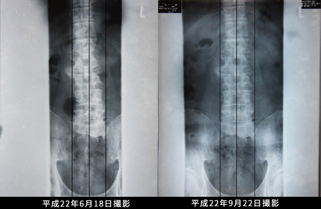 ビフォーアフター